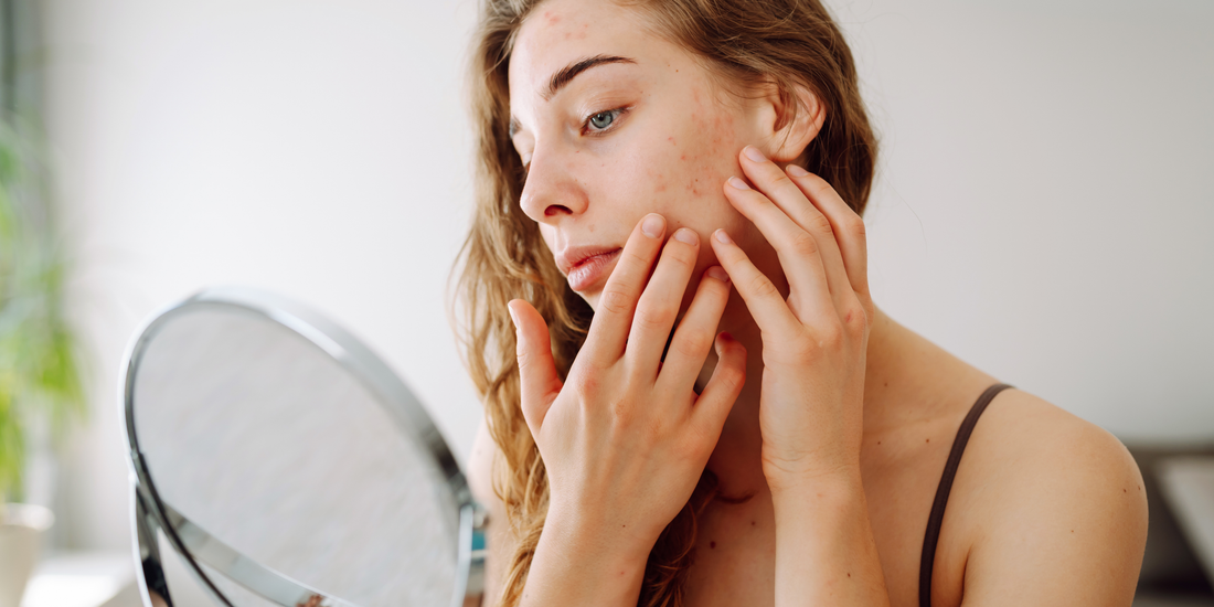 Female with irritated skin in front of mirror vearthy.com